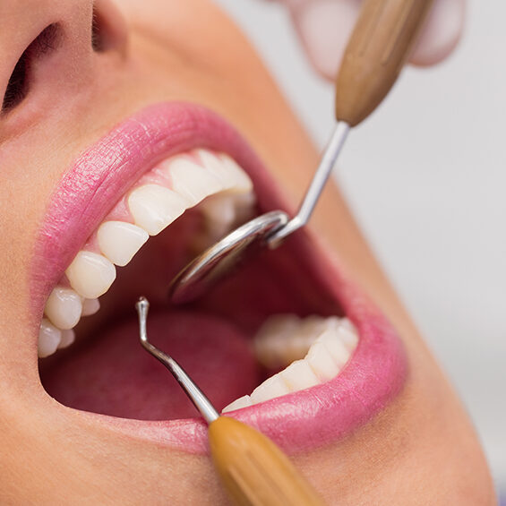 Dental Ultrasonic Scaling Treatment in Coimbatore