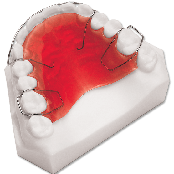 Orthodontic Treatment in Coimbatore